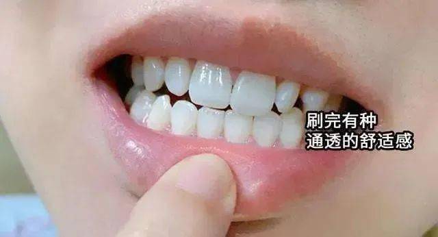 人保财险 ,人保有温度_口腔护理：为何“清新口气”比“刷牙”更让人心动？