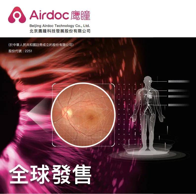 鹰瞳科技中期业绩预期盈利