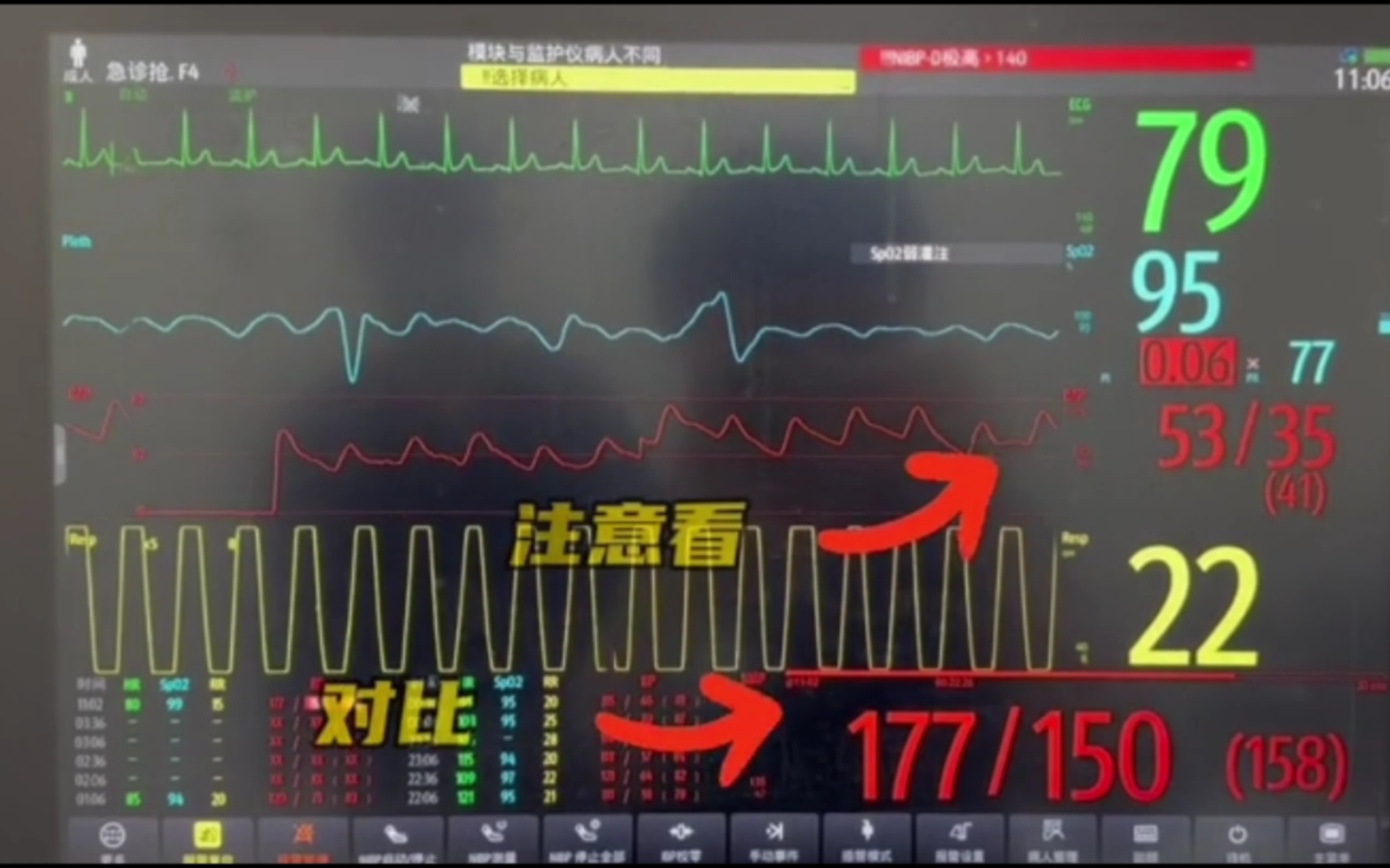 迈瑞医疗获得发明专利授权：“监护方法及设备”