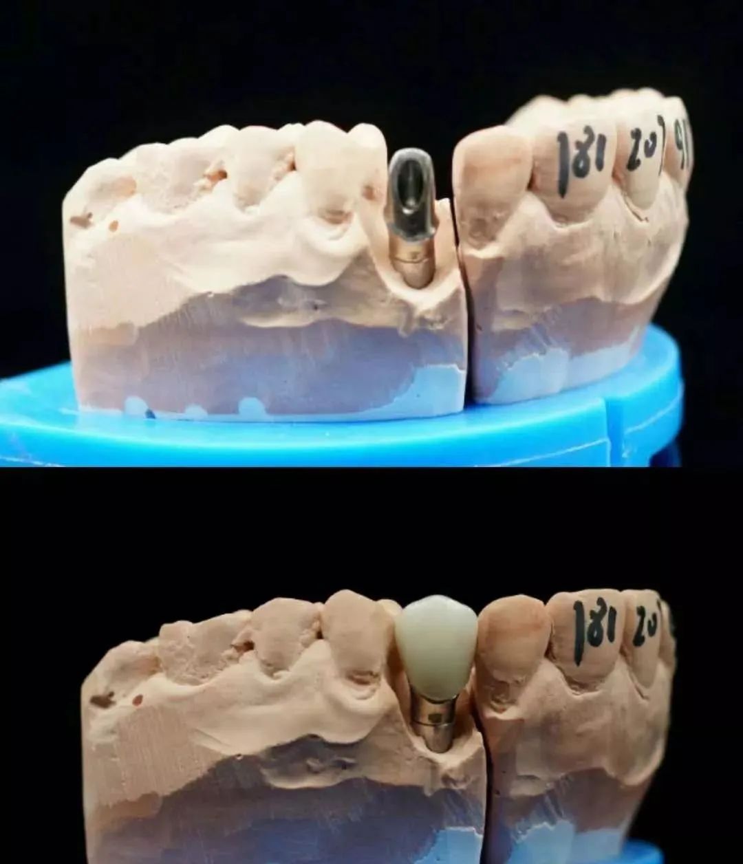 美亚光电获得外观设计专利授权：“口腔数字印模仪支架”